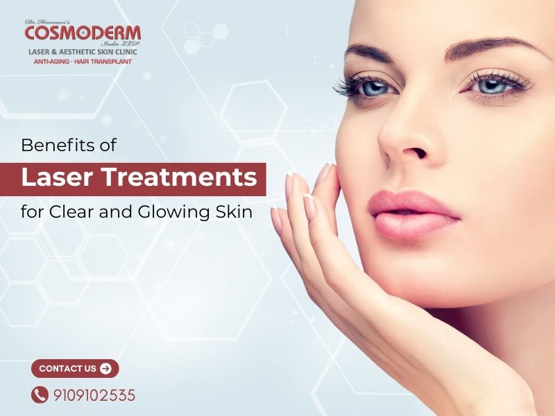 Discover the advantages of laser treatments for achieving clear and glowing skin at Cosmoderm Laser & Aesthetic Skin Clinic.