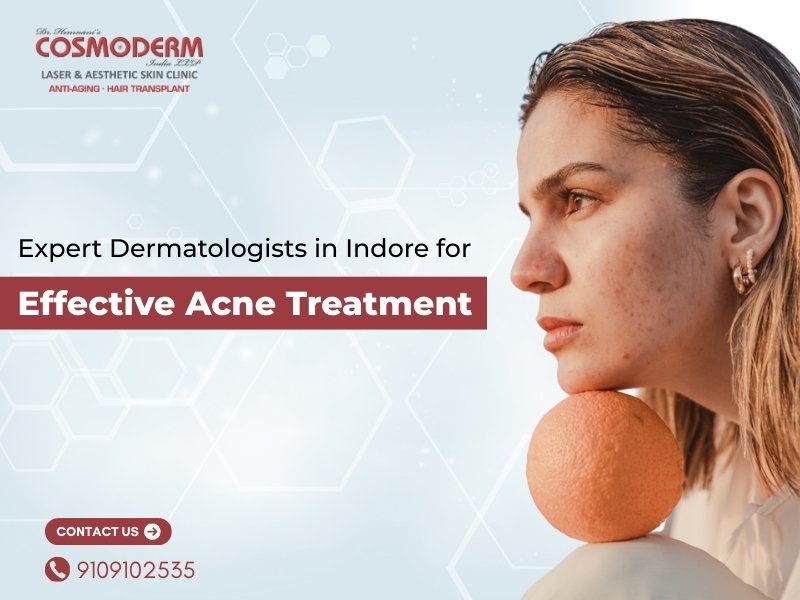Get clear, healthy skin with effective acne treatments from expert dermatologists in Indore at Cosmoderm Laser & Aesthetic Skin Clinic.