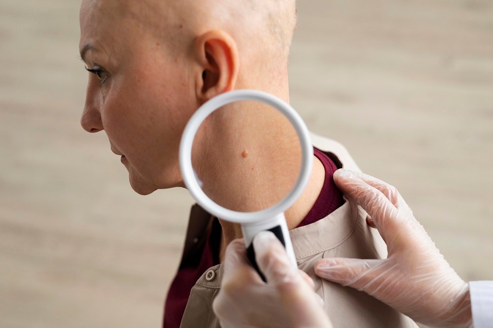 A dermatologist examining a mole on the side of a patient's neck using a magnifying glass.