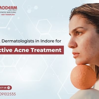 Get clear, healthy skin with effective acne treatments from expert dermatologists in Indore at Cosmoderm Laser & Aesthetic Skin Clinic.